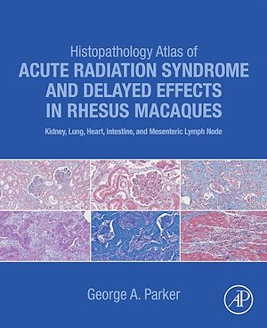 Téléchargez le livre :  Histopathology Atlas of Acute Radiation Syndrome and Delayed Effects in Rhesus Macaques