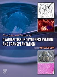 Téléchargez le livre :  Principles and Practice of Ovarian Tissue Cryopreservation and Transplantation