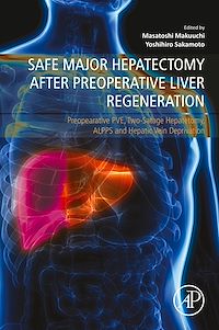 Téléchargez le livre :  Safe Major Hepatectomy after Preoperative Liver Regeneration
