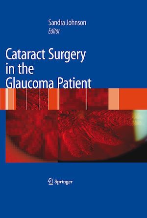 Téléchargez le livre :  Cataract Surgery in the Glaucoma Patient