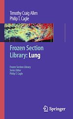 Download this eBook Frozen Section Library: Lung