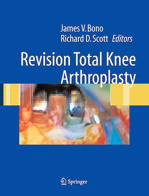 Téléchargez le livre :  Revision Total Knee Arthroplasty