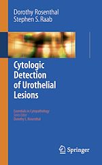 Télécharger le livre :  Cytologic Detection of Urothelial Lesions