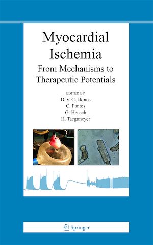 Téléchargez le livre :  Myocardial Ischemia