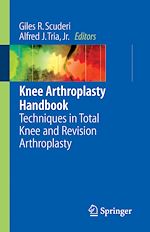 Télécharger le livre :  Knee Arthroplasty Handbook