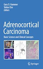 Télécharger le livre :  Adrenocortical Carcinoma