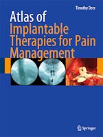 Télécharger le livre :  Atlas of Implantable Therapies for Pain Management