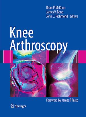 Téléchargez le livre :  Knee Arthroscopy