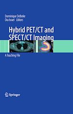 Télécharger le livre :  Hybrid PET/CT and SPECT/CT Imaging