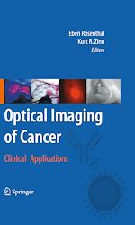 Télécharger le livre :  Optical Imaging of Cancer