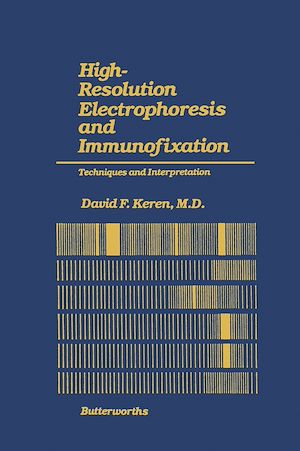 Download the eBook: High-Resolution Electrophoresis and Immunofixation