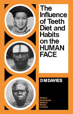 Téléchargez le livre :  The Influence of Teeth, Diet, and Habits on the Human Face