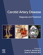 Télécharger le livre :  Carotid Artery Disease