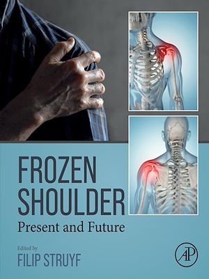 Téléchargez le livre :  Frozen Shoulder