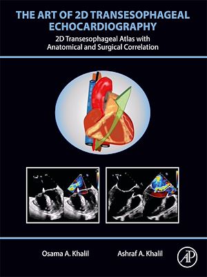 Téléchargez le livre :  The Art of 2D Transesophageal Echocardiography