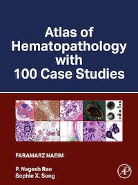 Téléchargez le livre :  Atlas of Hematopathology with 100 Case Studies