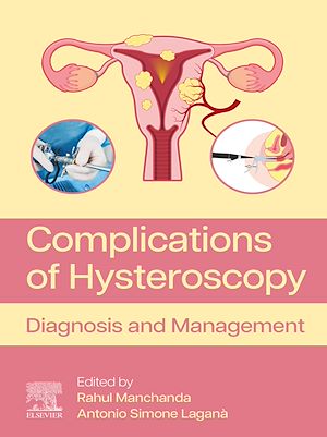 Téléchargez le livre :  Complications of Hysteroscopy