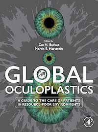 Téléchargez le livre :  Global Oculoplastics