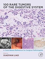 Télécharger le livre :  100 Rare Tumors of the Digestive System
