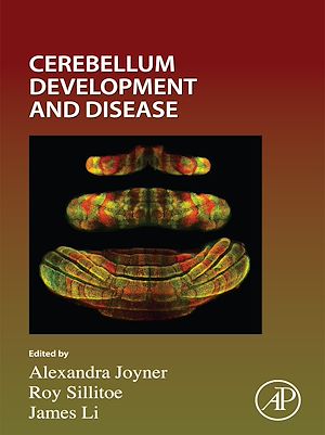 Download the eBook: Cerebellum Development and Disease