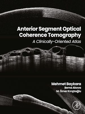 Téléchargez le livre :  Anterior Segment Optical Coherence Tomography