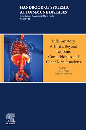 Download the eBook: Inflammatory Arthritis Beyond the Joints