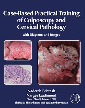 Téléchargez le livre :  Case-Based Practical Training of Colposcopy and Cervical Pathology