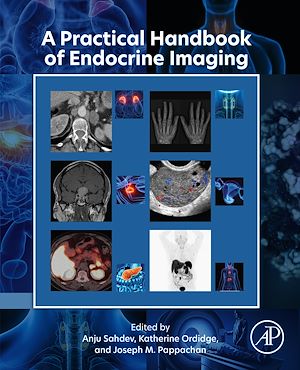 Téléchargez le livre :  A Practical Handbook of Endocrine Imaging