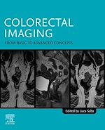 Télécharger le livre :  Colorectal Imaging