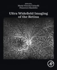 Téléchargez le livre :  Ultra Widefield Imaging of the Retina