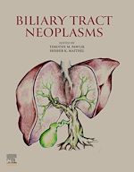 Télécharger le livre :  Biliary Tract Neoplasms
