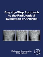 Download this eBook Step-by-step Approach to the Radiological Evaluation of Arthritis