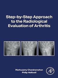 Download this ebook Step-by-step Approach to the Radiological Evaluation of Arthritis