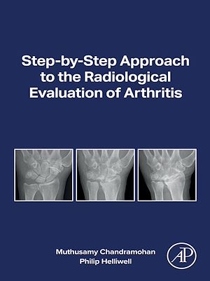 Download the eBook: Step-by-step Approach to the Radiological Evaluation of Arthritis