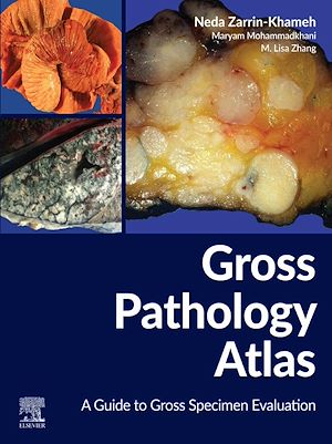 Download the eBook: Gross Pathology Atlas