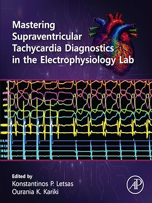 Download the eBook: Mastering Supraventricular Tachycardia Diagnostics in the Electrophysiology Lab