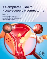 Download this ebook A Complete Guide to Hysteroscopic Myomectomy