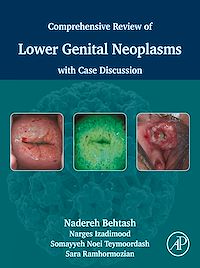 Download this ebook Comprehensive review of lower genital neoplasms