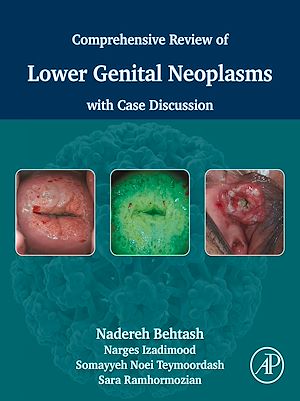 Download the eBook: Comprehensive review of lower genital neoplasms