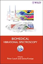 Download this eBook Biomedical Vibrational Spectroscopy