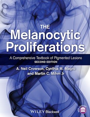 Download the eBook: The Melanocytic Proliferations