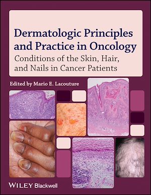 Téléchargez le livre :  Dermatologic Principles and Practice in Oncology