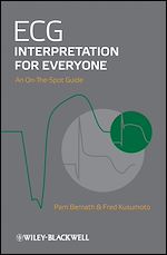 Download this eBook ECG Interpretation for Everyone