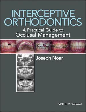 Download the eBook: Interceptive Orthodontics