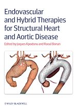 Télécharger le livre :  Endovascular and Hybrid Therapies for Structural Heart and Aortic Disease
