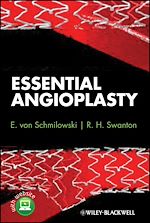 Télécharger le livre :  Essential Angioplasty