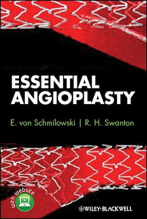 Téléchargez le livre :  Essential Angioplasty