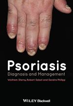Télécharger le livre :  Psoriasis