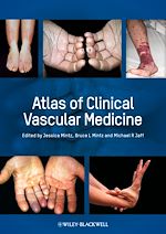 Télécharger le livre :  Atlas of Clinical Vascular Medicine