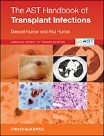 Télécharger le livre :  The AST Handbook of Transplant Infections